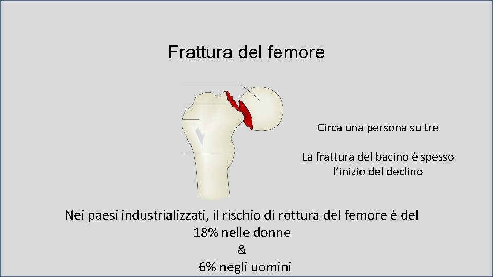 Frattura del femore Circa una persona su tre La frattura del bacino è spesso