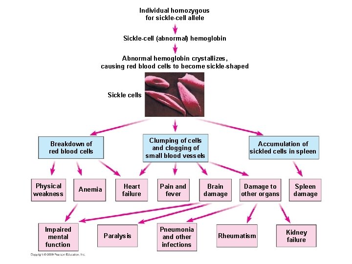 Individual homozygous for sickle-cell allele Sickle-cell (abnormal) hemoglobin Abnormal hemoglobin crystallizes, causing red blood