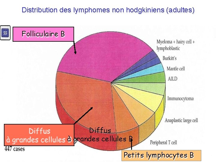 Distribution des lymphomes non hodgkiniens (adultes) Folliculaire B Diffus à grandes cellules B D.