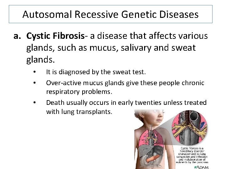 Autosomal Recessive Genetic Diseases a. Cystic Fibrosis- a disease that affects various glands, such