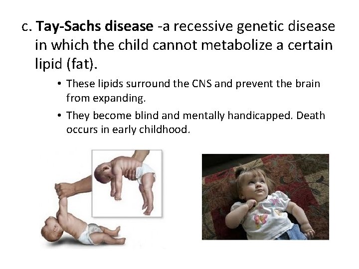 c. Tay-Sachs disease -a recessive genetic disease in which the child cannot metabolize a