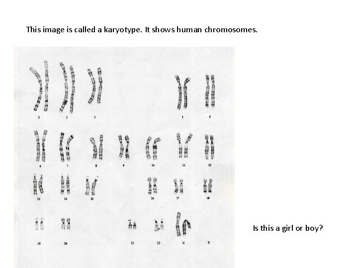 This image is called a karyotype. It shows human chromosomes. Is this a girl