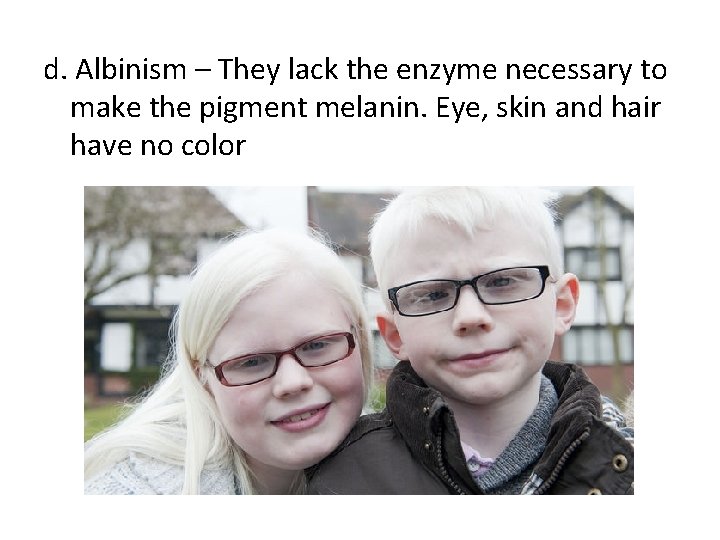 d. Albinism – They lack the enzyme necessary to make the pigment melanin. Eye,