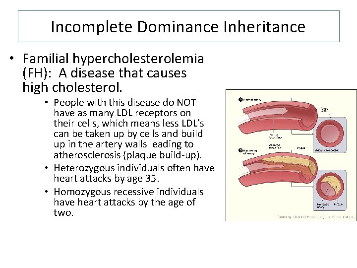 Incomplete Dominance Inheritance • Familial hypercholesterolemia (FH): A disease that causes high cholesterol. •