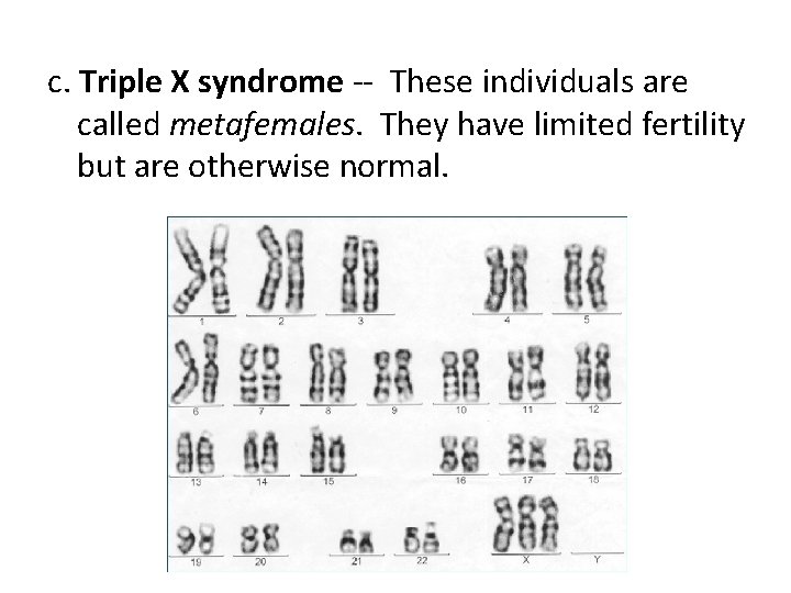 c. Triple X syndrome -- These individuals are called metafemales. They have limited fertility