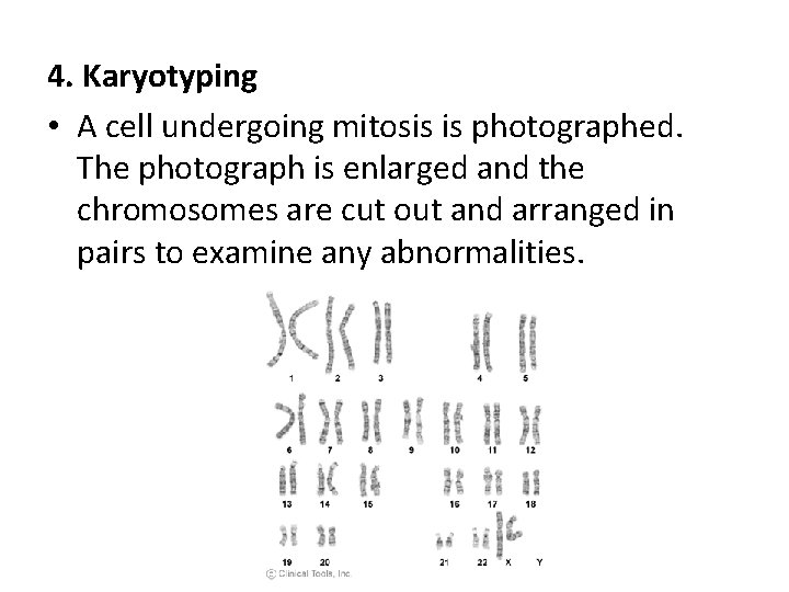 4. Karyotyping • A cell undergoing mitosis is photographed. The photograph is enlarged and