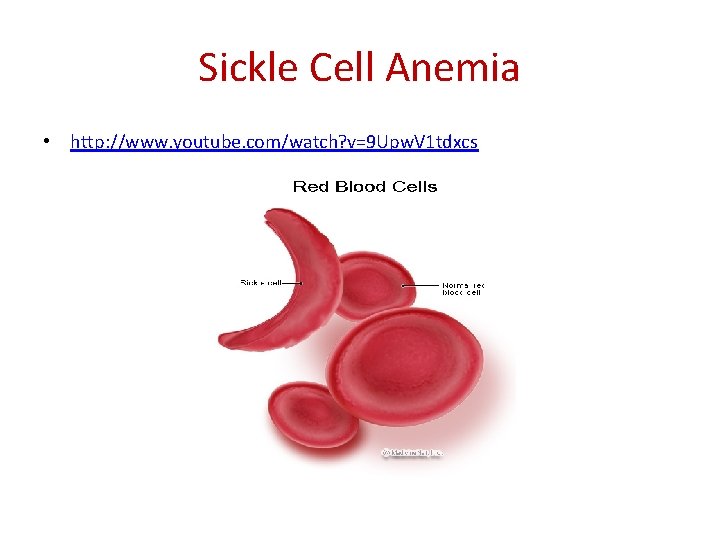 Sickle Cell Anemia • http: //www. youtube. com/watch? v=9 Upw. V 1 tdxcs 