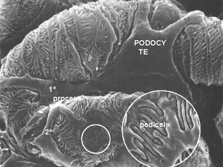 PODOCY TE 1° process 2° pedicels 