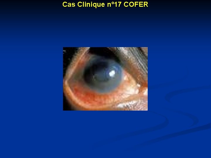 Cas Clinique n° 17 COFER 