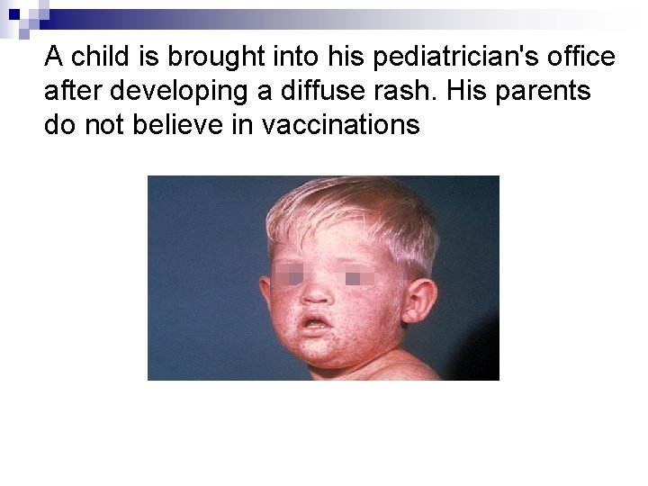 A child is brought into his pediatrician's office after developing a diffuse rash. His