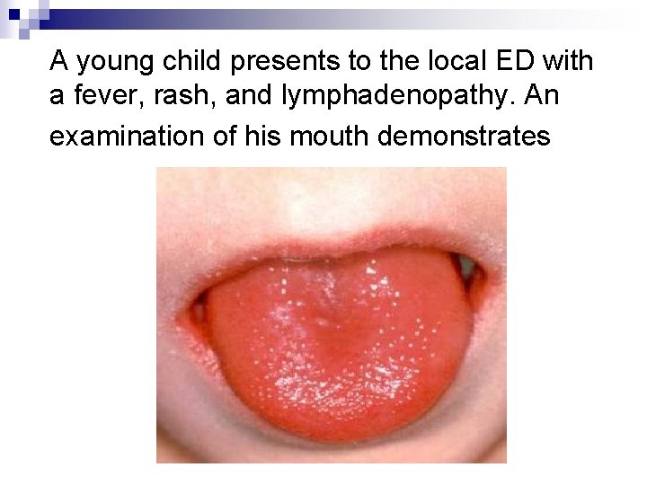 A young child presents to the local ED with a fever, rash, and lymphadenopathy.