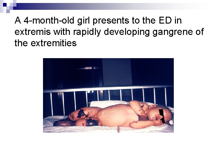 A 4 -month-old girl presents to the ED in extremis with rapidly developing gangrene