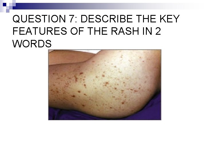 QUESTION 7: DESCRIBE THE KEY FEATURES OF THE RASH IN 2 WORDS 