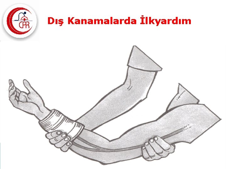 Dış Kanamalarda İlkyardım 