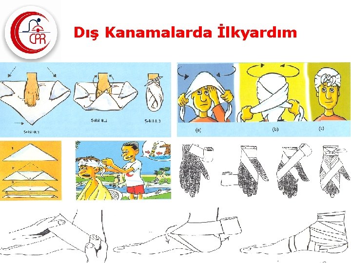 Dış Kanamalarda İlkyardım 