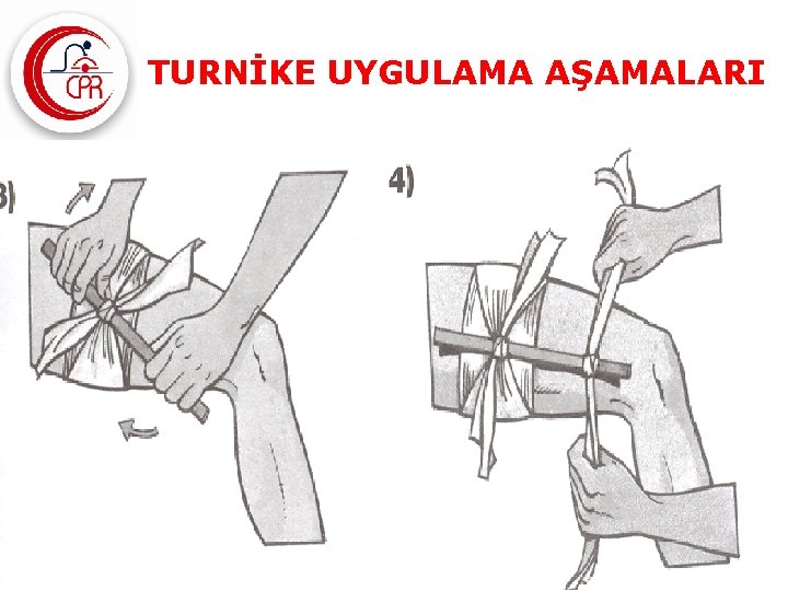 TURNİKE UYGULAMA AŞAMALARI www. cprilkyardim. com 