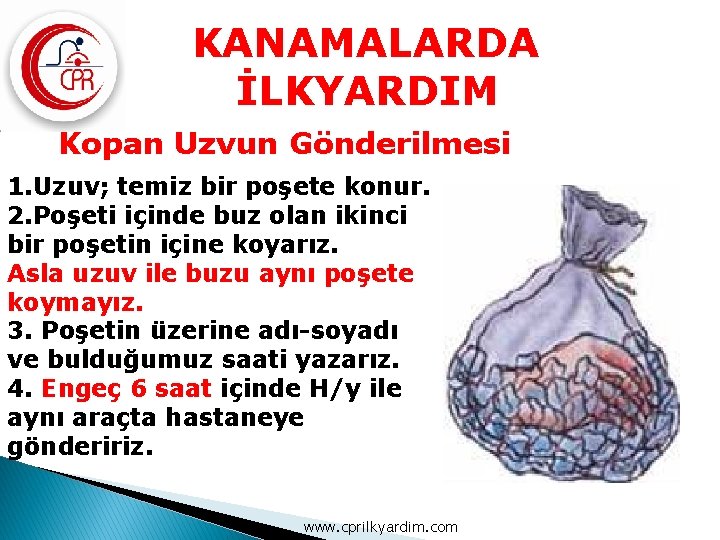 KANAMALARDA İLKYARDIM Kopan Uzvun Gönderilmesi 1. Uzuv; temiz bir poşete konur. 2. Poşeti içinde