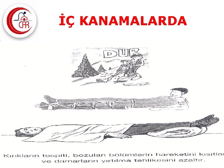 İÇ KANAMALARDA İLKYARDIM www. cprilkyardim. com 