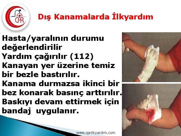 Dış Kanamalarda İlkyardım Hasta/yaralının durumu değerlendirilir Yardım çağırılır (112) Kanayan yer üzerine temiz bir