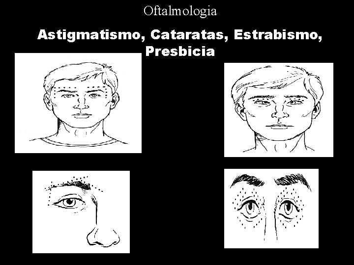 Oftalmologia Astigmatismo, Cataratas, Estrabismo, Presbicia 