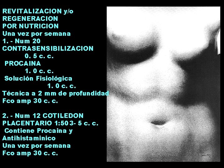 REVITALIZACION y/o REGENERACION POR NUTRICION Una vez por semana 1. - Num 20 CONTRASENSIBILIZACION REVITALIZACION y/o REGENERACION POR NUTRICION Una vez por semana 1. - Num 20 CONTRASENSIBILIZACION