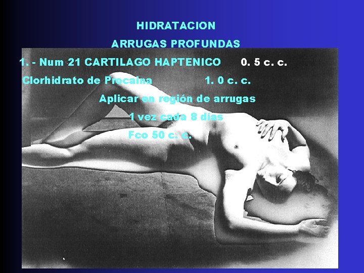 HIDRATACION ARRUGAS PROFUNDAS 1. - Num 21 CARTILAGO HAPTENICO Clorhidrato de Procaina 0. 5