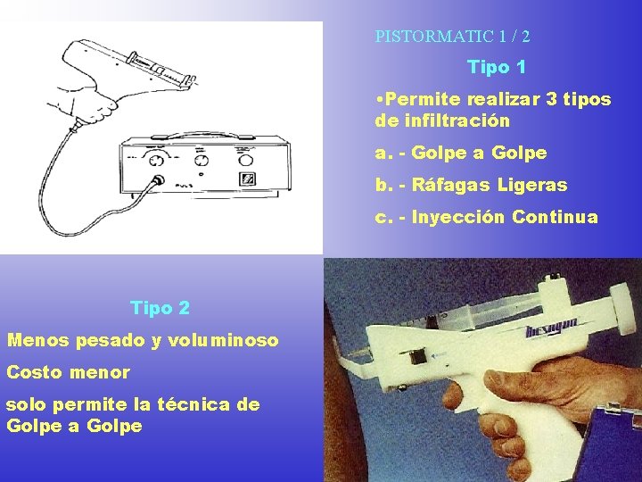 PISTORMATIC 1 / 2 Tipo 1 • Permite realizar 3 tipos de infiltración a.