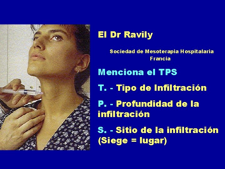 El Dr Ravily Sociedad de Mesoterapia Hospitalaria Francia Menciona el TPS T. - Tipo