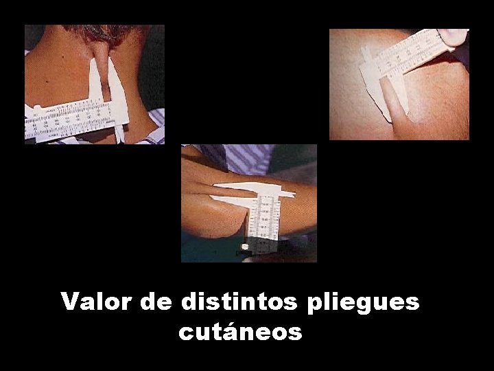 Valor de distintos pliegues cutáneos 