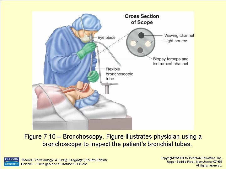 Figure 7. 10 – Bronchoscopy. Figure illustrates physician using a bronchoscope to inspect the