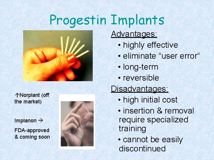 Progestin Implants áNorplant (off the market) Implanon FDA-approved & coming soon Advantages: • highly