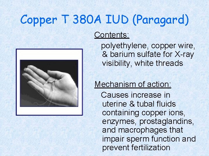Copper T 380 A IUD (Paragard) Contents: polyethylene, copper wire, & barium sulfate for