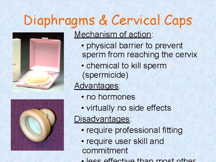 Diaphragms & Cervical Caps Mechanism of action: • physical barrier to prevent sperm from