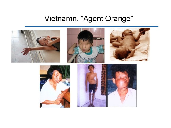 Vietnamn, ”Agent Orange” 
