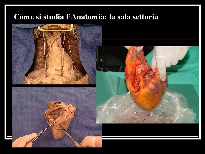 Come si studia l’Anatomia: la sala settoria 