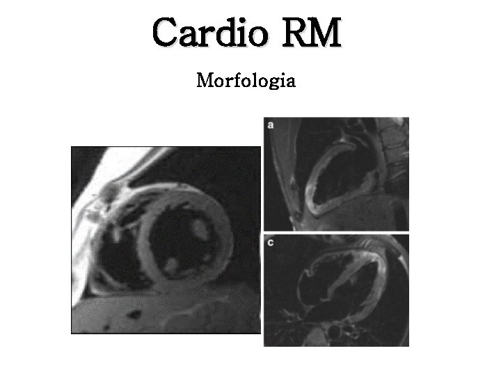 Cardio RM Morfologia 