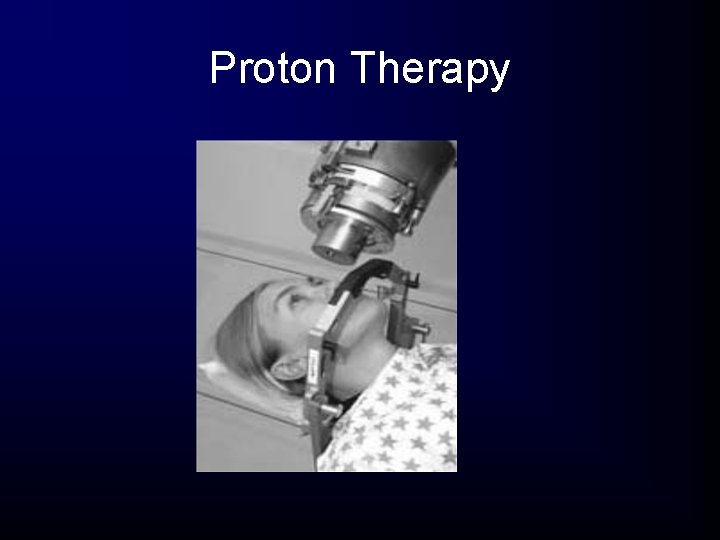 Proton Therapy Proton Therapy