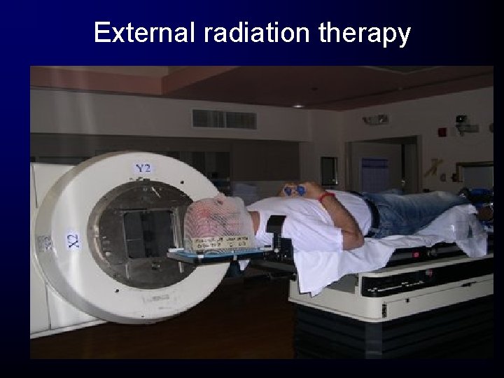 External radiation therapy External radiation therapy