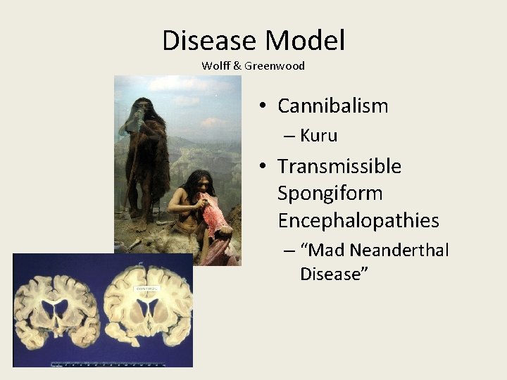 Disease Model Wolff & Greenwood • Cannibalism – Kuru • Transmissible Spongiform Encephalopathies –