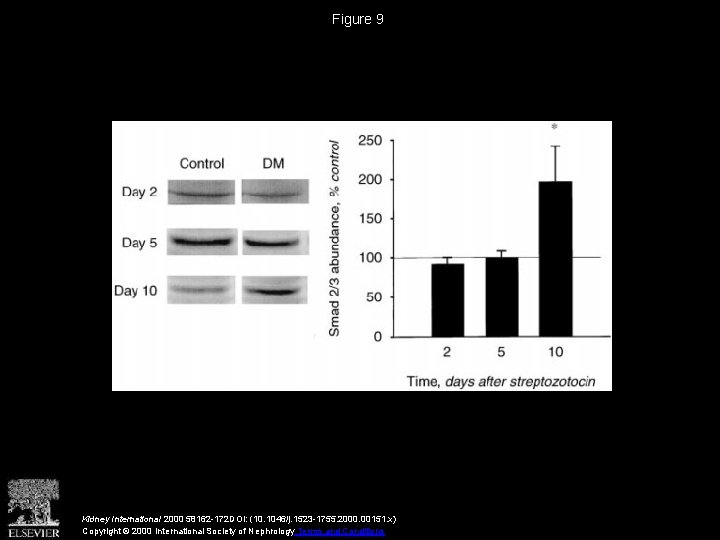 Figure 9 Kidney International 2000 58162 -172 DOI: (10. 1046/j. 1523 -1755. 2000. 00151.