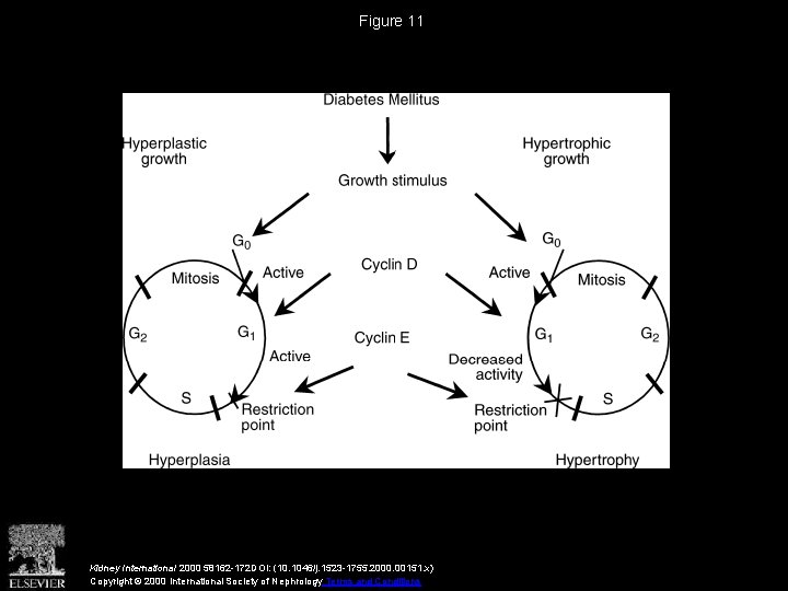 Figure 11 Kidney International 2000 58162 -172 DOI: (10. 1046/j. 1523 -1755. 2000. 00151.