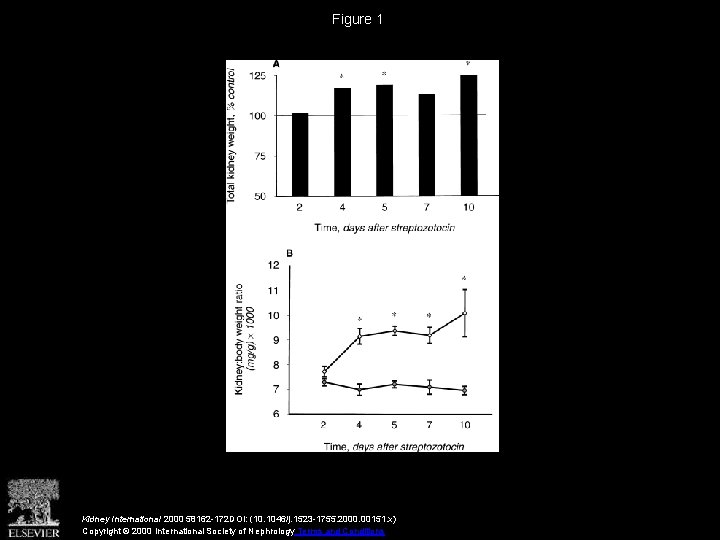 Figure 1 Kidney International 2000 58162 -172 DOI: (10. 1046/j. 1523 -1755. 2000. 00151.