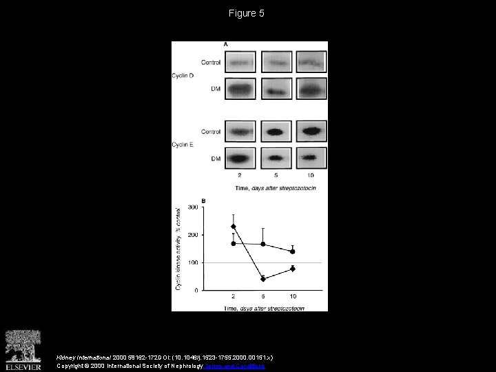 Figure 5 Kidney International 2000 58162 -172 DOI: (10. 1046/j. 1523 -1755. 2000. 00151.