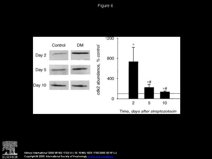 Figure 6 Kidney International 2000 58162 -172 DOI: (10. 1046/j. 1523 -1755. 2000. 00151.