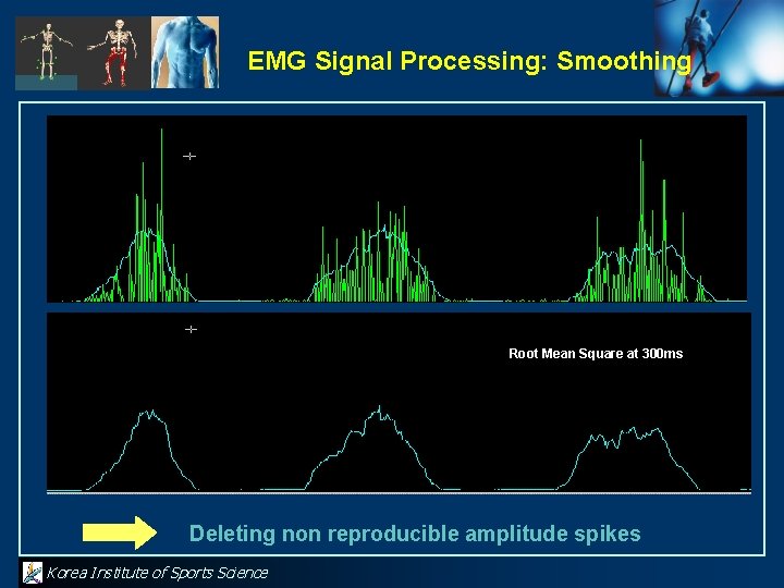 EMG Signal Processing: Smoothing Root Mean Square at 300 ms Deleting non reproducible amplitude