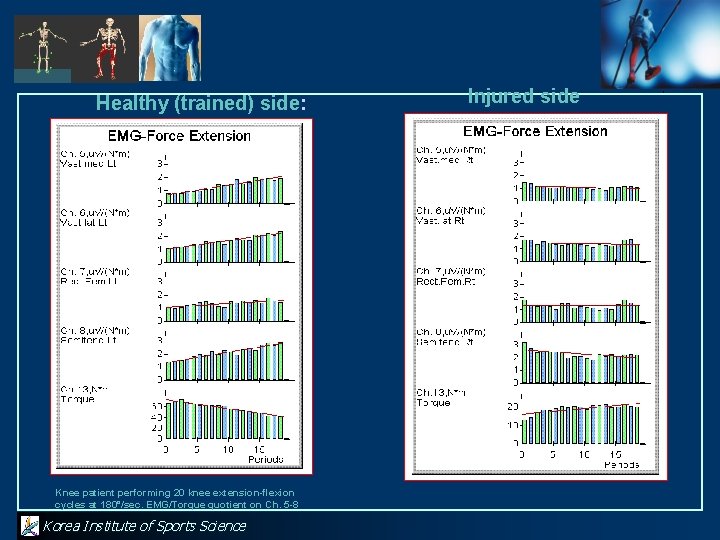 Healthy (trained) side: Knee patient performing 20 knee extension-flexion cycles at 180°/sec. EMG/Torque quotient