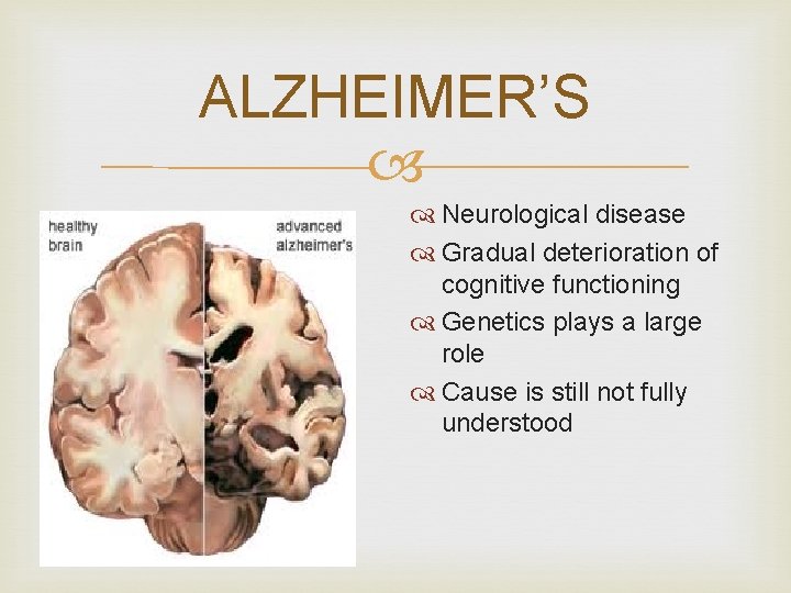 ALZHEIMER’S Neurological disease Gradual deterioration of cognitive functioning Genetics plays a large role Cause