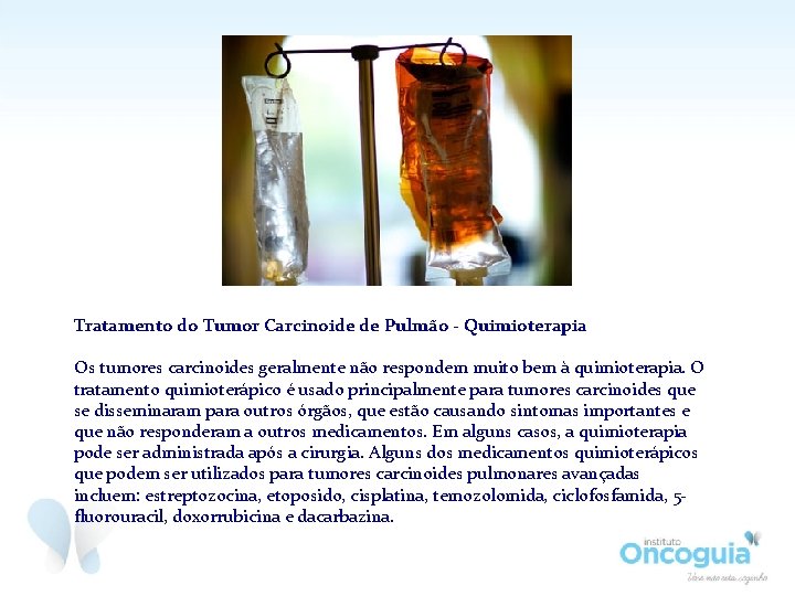 Tratamento do Tumor Carcinoide de Pulmão - Quimioterapia Os tumores carcinoides geralmente não respondem