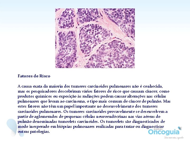 Fatores de Risco A causa exata da maioria dos tumores carcinoides pulmonares não é