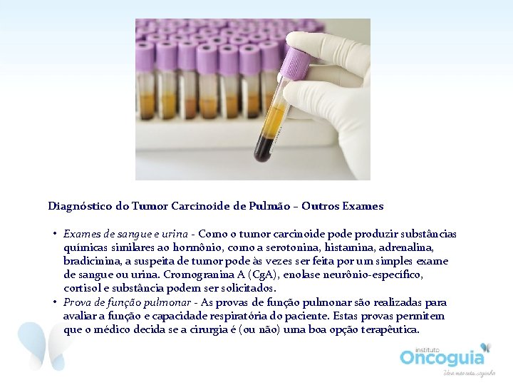 Diagnóstico do Tumor Carcinoide de Pulmão – Outros Exames • Exames de sangue e